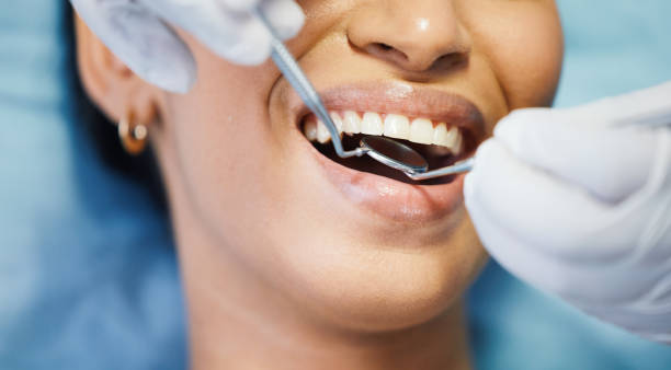 Best Emergency Treatment for Oral Infections in Houma, LA