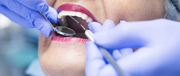 Best Walk-In Emergency Dental Services in Houma, LA